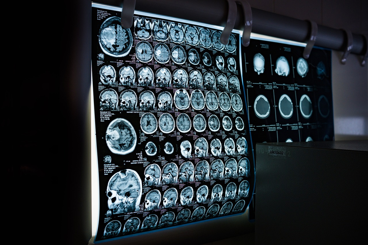 AI innovations revolutionizing home-based care delivery and efficiency